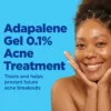 DIFFERIN - Differin Gel Adapalene 0.1% Acne Treatment 15g - Image 3