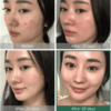 SOME BY MI - AHA, BHA, PHA 30 Days Miracle Toner (New Packaging) - Image 6